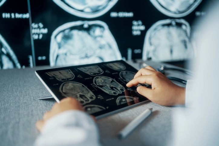 healthcare professional looking at patient's scan