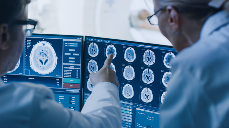 two CT technologists reading a CT brain scan on a monitor