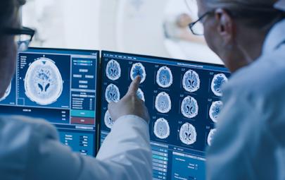 two CT technologists reading a CT brain scan on a monitor two CT technologists reading a CT brain scan on a monitor